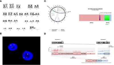 Co-existence of KMT2A::SEPTIN6 fusion and DIS3 variant in a pediatric case with acute myeloid leukemia: a case report and literature review